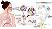 Миниатюра для COVID-19