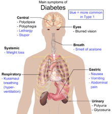 BNO – Endokrin, táplálkozási és anyagcsere betegségek – Wikipédia