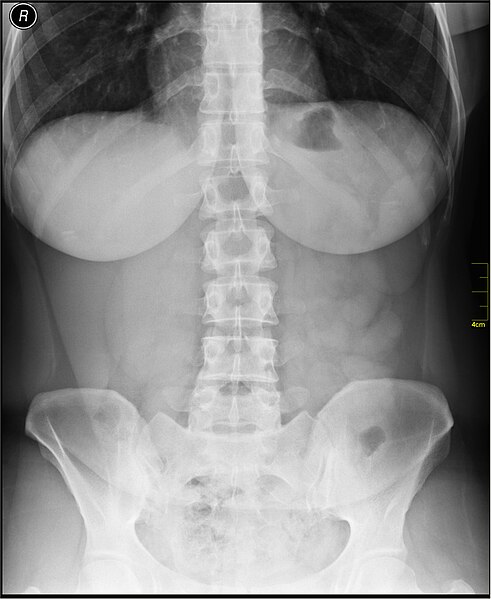 File:Medical X-Ray imaging ADB02 nevit.jpg