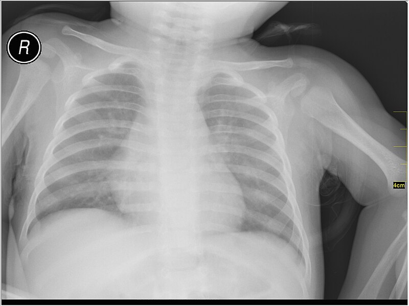File:Medical X-Ray imaging WPP07 nevit.jpg