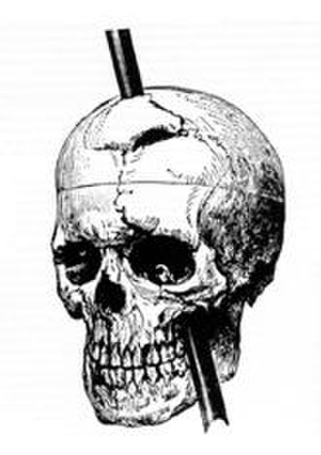 ไฟล์:Phineas_gage_-_1868_skull_diagram.jpg