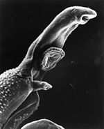 צילום דרך מיקרוסקופ אלקטרונים סורק של זכר עלקת הבילהרציה יחד עם נקבה ש"מציצה" מתוך ה"כיס"