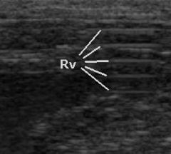 Sonografie: Anwendungen in der Medizin, Geschichte der Sonografie, Bildgebung