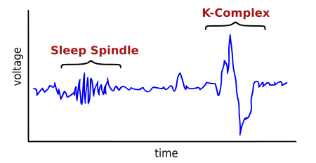 Sleep spindle