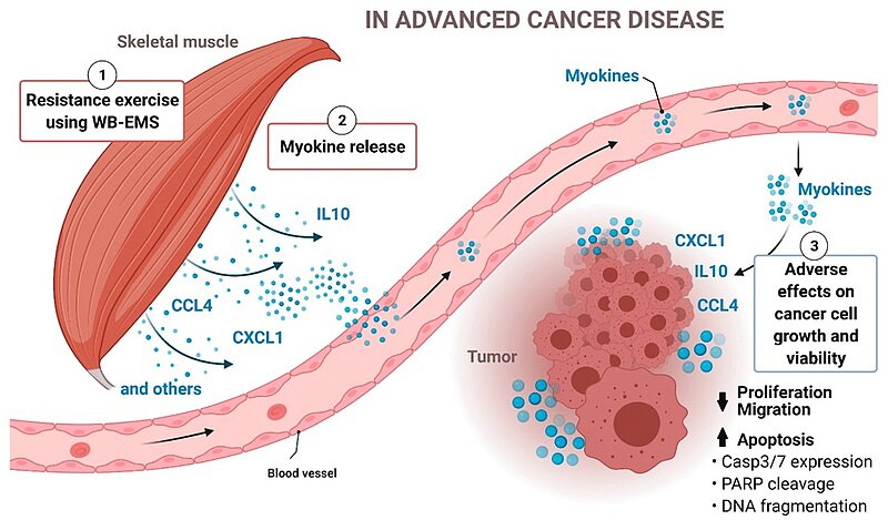 File:The model depicts a mechanistic linkage between muscle activation by WB-EMS-mediated resistance exercise and cancer cell death in advanced cancer disease.jpg