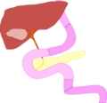 simple diagram of total gastrectomy with jejunal_interposition