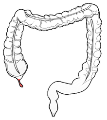 Anatomy-human-appendix-in-colon.png