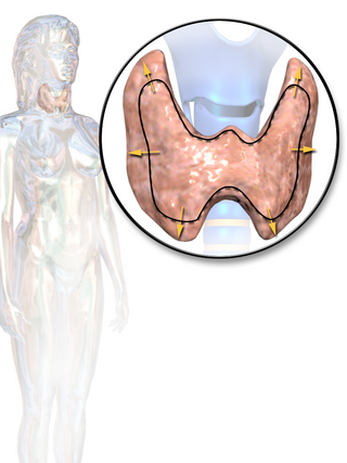 <span class="mw-page-title-main">Thyroid disease</span> Medical condition