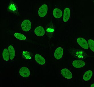 Homogeneous immunofluorescence staining pattern of double stranded DNA antibodies on HEp-20-10 cells. Interphase cells show homogeneous nuclear staining while mitotic cells show staining of the condensed chromosome regions. DsDNA antibodies.jpg