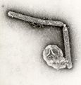 This transmission electron micrograph (TEM), taken at a magnification of 108,000x, revealed the ultrastructural details of two avian influenza A (H5N1) virions, a type of bird flu virus, which is a subtype of avian influenza A.