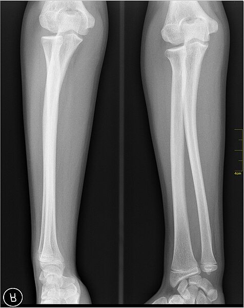 File:Medical X-Ray imaging FOV04 nevit.jpg