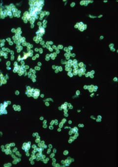 Імунофлюоресцентне зображення Neisseria gonorrhoeae