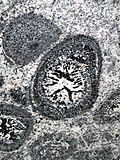 Thumbnail for Orbicular granite