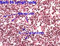 Miniatura para Célula epitelial reticular