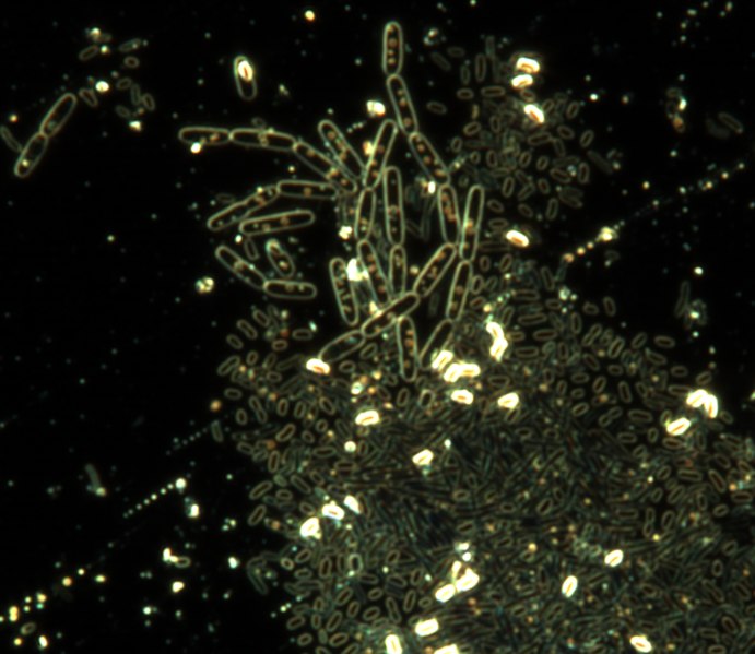 File:Spores of Bacillus subtilis.tif