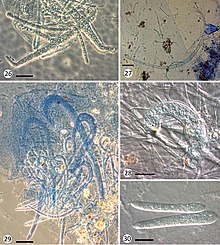 Amoebidiales (10.3897-mycokeys.67.52055) Figures 26-30.jpg