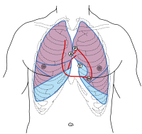 Bruit cardiaque