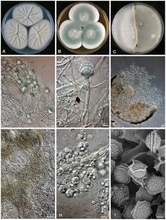 Aspergillus felis