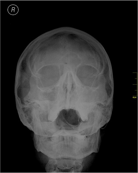 File:Medical X-Ray imaging FVS04 nevit.jpg