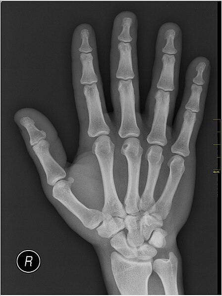 File:Medical X-Ray imaging PRZ06 nevit.jpg