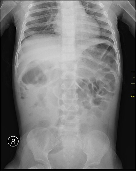 File:Medical X-Ray imaging SJD07 nevit.jpg