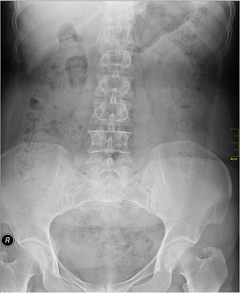 File:Medical X-Ray imaging VLR07 nevit.jpg