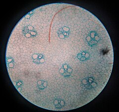 Microscopic Image of Monocot stem T.S. Angiosperm.jpg