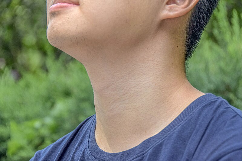 File:My Friend's Neck 02.jpg