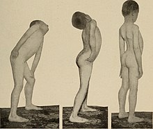 maladies nerveuses et mentales (1908) (14.775.871.594) .jpg