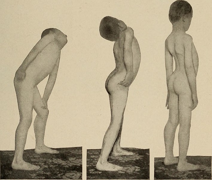 File:Nervous and mental diseases (1908) (14775871594).jpg