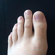 What Does It Mean When Your Second Toe Is Longer Than Your Big Toe? – Fix  Your Feet