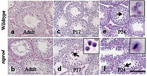 Spermatocyte