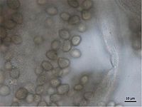 Gem-shaped sporangiospores of R. stolonifer showing characteristic striations. Rhizopus stolonifer2.jpg