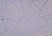 Visió a través d'un microscopi, unes quantes espores en forma de fil es veuen distribuïdes pel camp de visió.