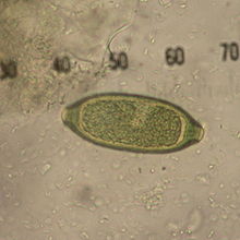 Trichuris sp.JPG