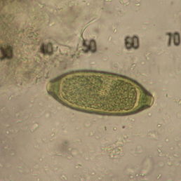 Trichuris