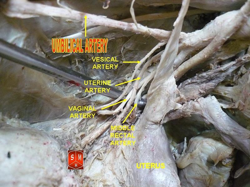 File:Umbilical artery.jpg