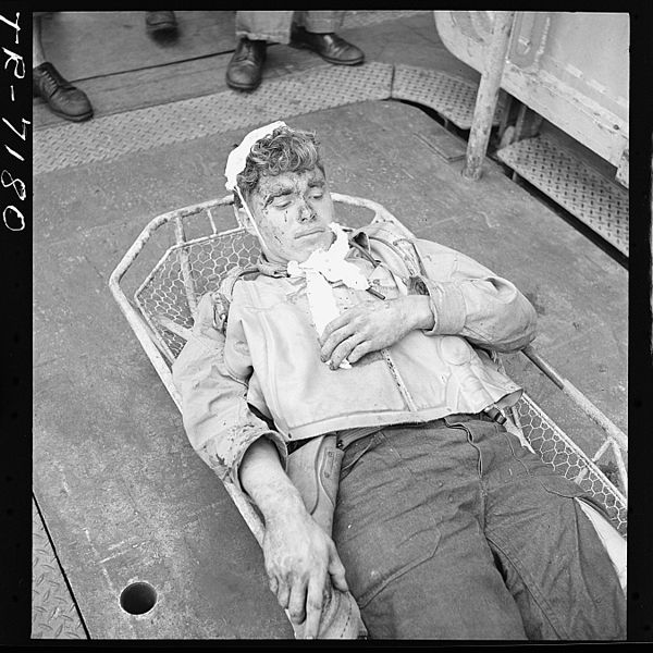 File:Aircrewman, wounded during raid on Rabaul, on board the USS Saratoga (CV-3). Alva Parker (ARM1) who suffered shrapnel... - NARA - 520891.jpg