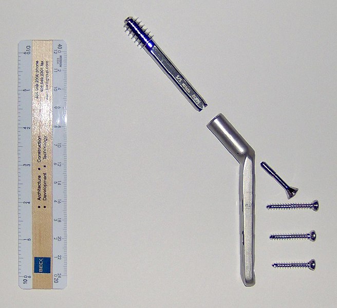 File:Cdm hip hardware 369.jpg