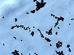 Cryptococcus Gram film.jpg
