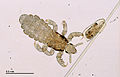 Head louse (251 27) Adult and egg, from a human host.jpg