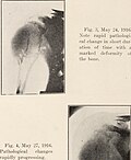 Thumbnail for File:Journal of roentgenology (1918) (14571450368).jpg