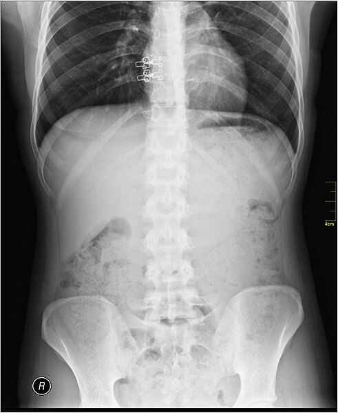 File:Medical X-Ray imaging UBE07 nevit.jpg