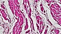 Micropreparação histológica de tecido muscular cardíaco.  Microscopia óptica, × 200, coloração de hematoxilina-eosina