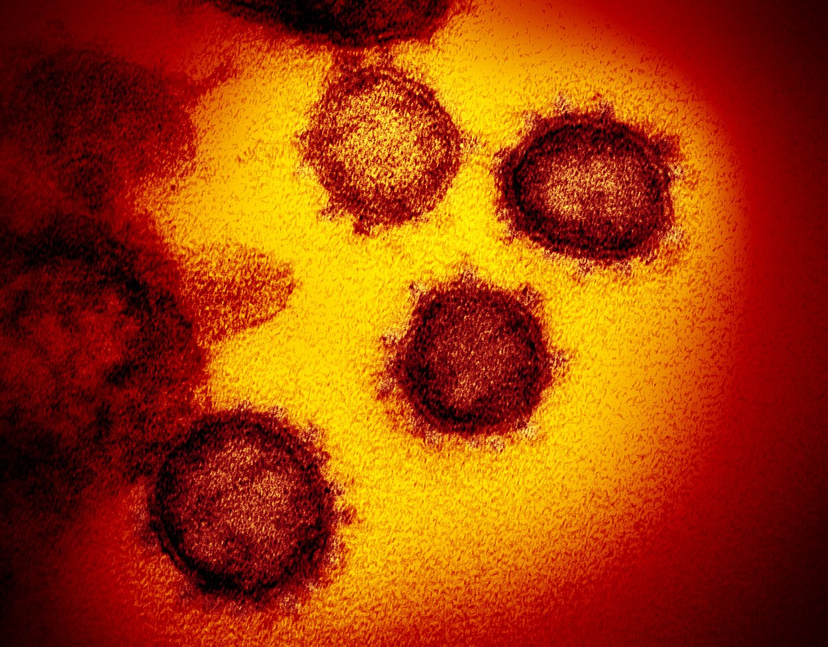 Ultrastructural analysis of SARS-CoV-2 interactions with the host