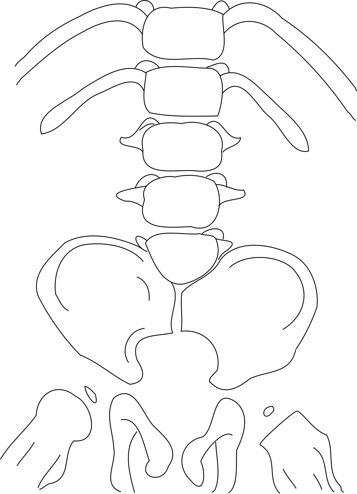 Caudal regression syndrome - Wikipedia