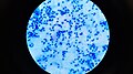 Spermatozoa in Ziehl-Neelsen stained smear of Semen.jpg