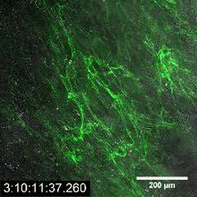 File:Memvisualisasikan-tropoelastin-in-a-long-term-manusia-elastis-serat-cell-culture-model-srep20378-s1.ogv