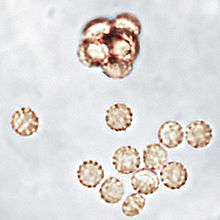 Afanoask fulvescens ascospores.jpg