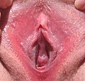 Vestibul vaginal